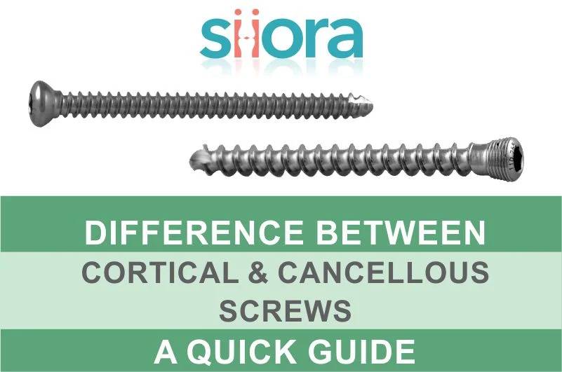 What is the Difference Between Cortical and Cancellous&nbsp;Screws?
