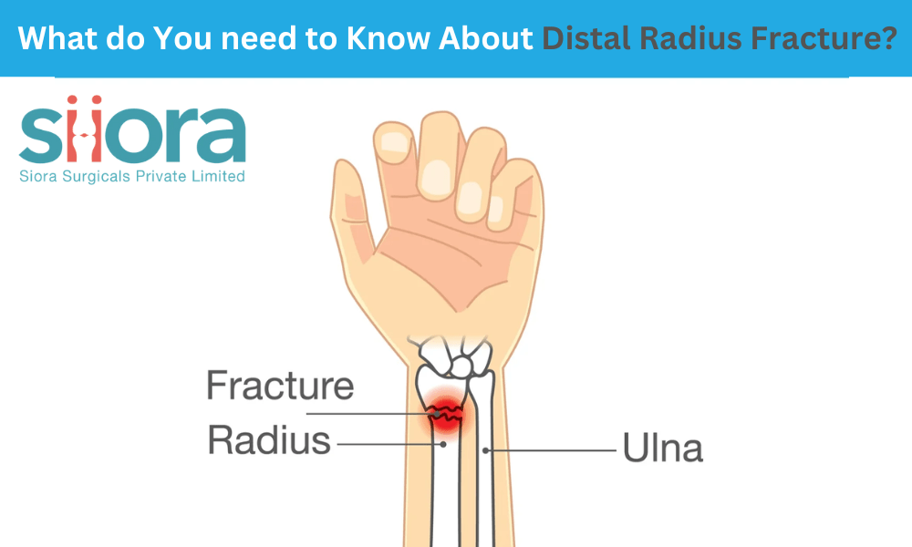 What do You need to Know About Distal Radius&nbsp;Fracture?